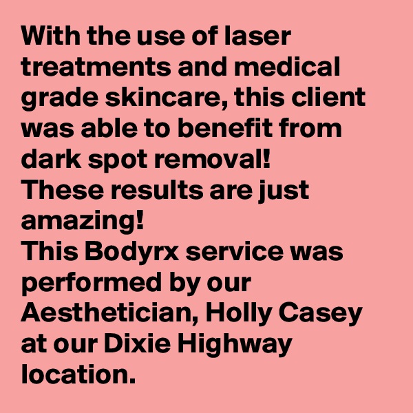 With the use of laser treatments and medical grade skincare, this client was able to benefit from dark spot removal!
These results are just amazing! 
This Bodyrx service was performed by our Aesthetician, Holly Casey at our Dixie Highway location.