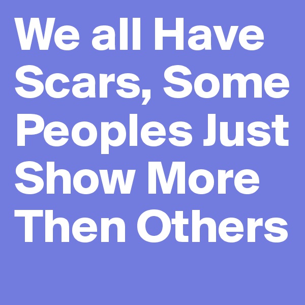 We all Have Scars, Some Peoples Just Show More Then Others