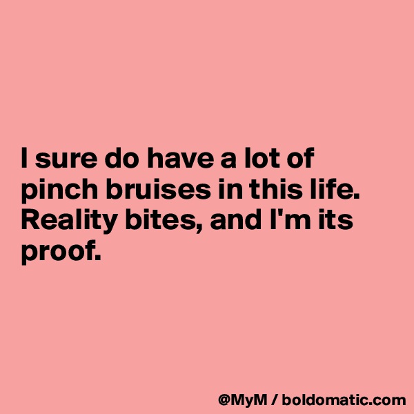 



I sure do have a lot of pinch bruises in this life. Reality bites, and I'm its proof.



