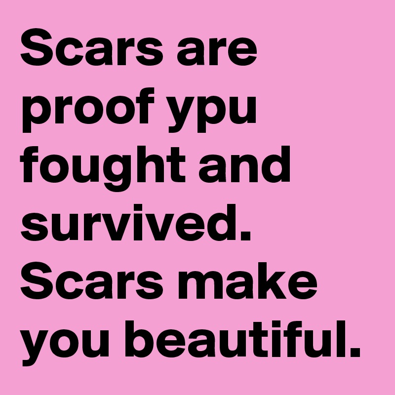 Scars are proof ypu fought and survived.
Scars make you beautiful.