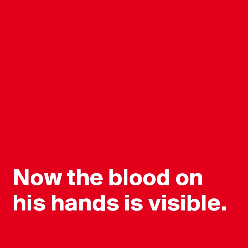 





Now the blood on his hands is visible. 