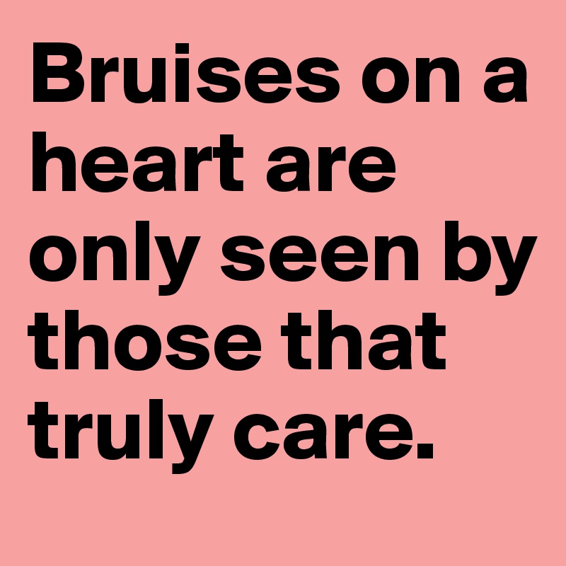 Bruises on a heart are only seen by those that truly care. 