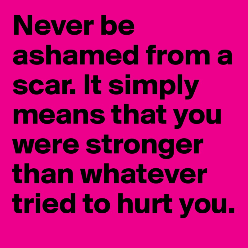 Never be ashamed from a scar. It simply
means that you were stronger than whatever tried to hurt you.