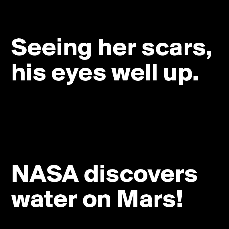 
Seeing her scars,
his eyes well up.



NASA discovers water on Mars!